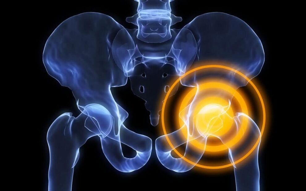 pain in the hip joint image 2