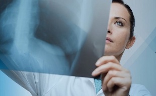 diagnostics of cervical osteochondrosis